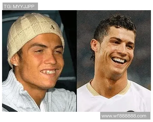 足球明星整容前后对比揭秘全过程及其背后的故事分享